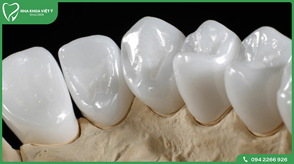 Đôi nét về răng sứ Zirconia