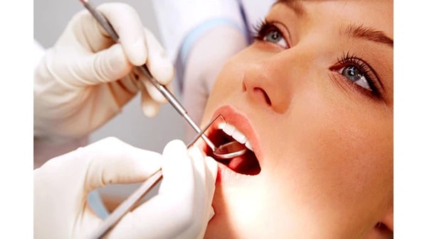 Chăm sóc răng miệng đúng cách để ngăn ngừa cao răng