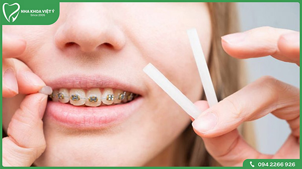 Những cách giảm đau sau khi thực hiện siết răng