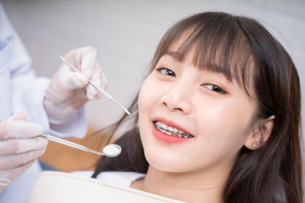 Giai đoạn tái khám siết răng định kỳ