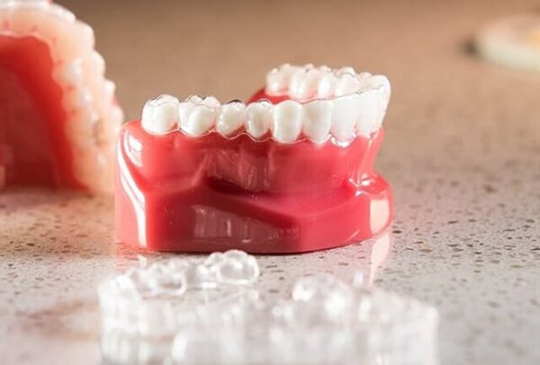 Ưu và nhược điểm của phương pháp niềng răng không mắc cài 3D Clear