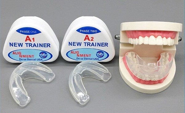 Niềng răng trainer là gì? Khi nào cần niềng răng trainer