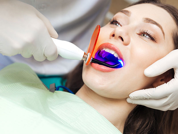 Trám răng Laser Tech – Công nghệ trám răng hiện đại nhất
