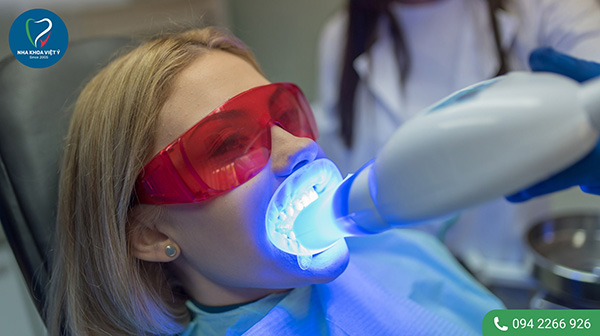 Nên tẩy trắng răng bằng phương pháp nào là hiệu quả nhất?