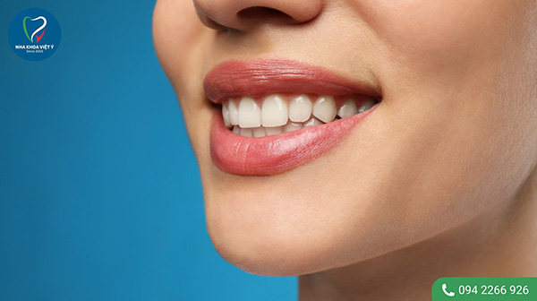 Răng vàng bẩm sinh có tẩy trắng được không?