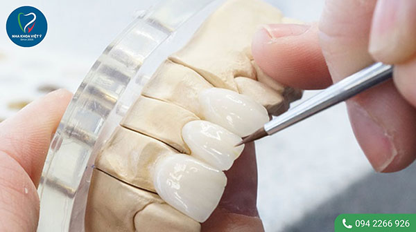 Cách khắc phục khi bọc răng sứ bị gãy hiệu quả