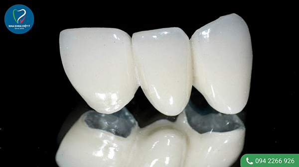 Bọc răng sứ cho răng cửa bị mẻ nên chọn loại sứ nào?