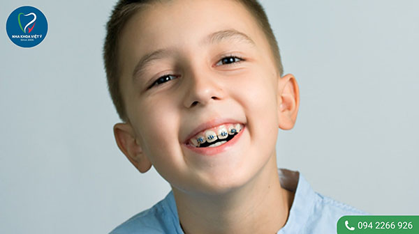 Niềng răng ở độ tuổi nào là thích hợp?