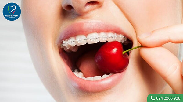 Lưu ý về chế độ ăn uống sau khi niềng răng