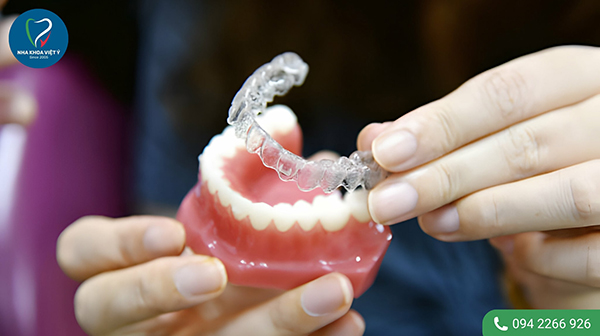 Quy trình niềng răng trong suốt