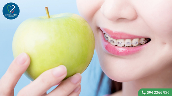 Những lợi ích của việc niềng răng