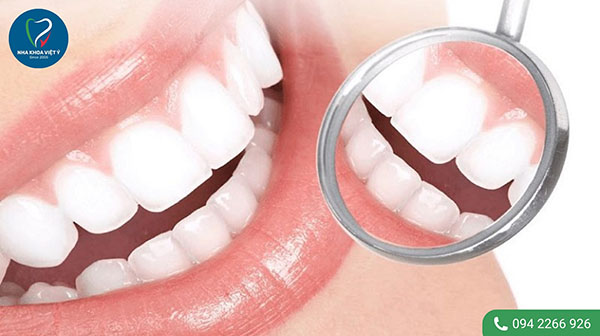 Phương pháp bọc sứ cho răng thưa