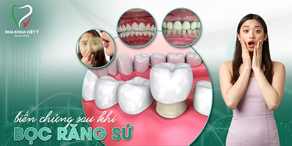 Những biến chứng sau khi bọc răng sứ nguy hiểm có thể bạn chưa biết
