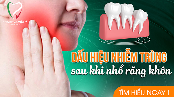 Dấu hiệu nhiễm trùng sau khi nhổ răng khôn là gì?