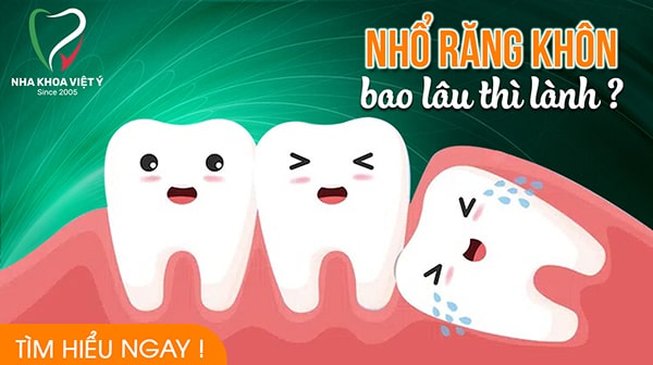 Nhổ răng khôn bao lâu thì lành lại bình thường?
