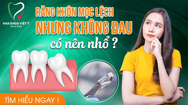 Khi răng khôn mọc lệch nhưng không đau có nên nhổ?