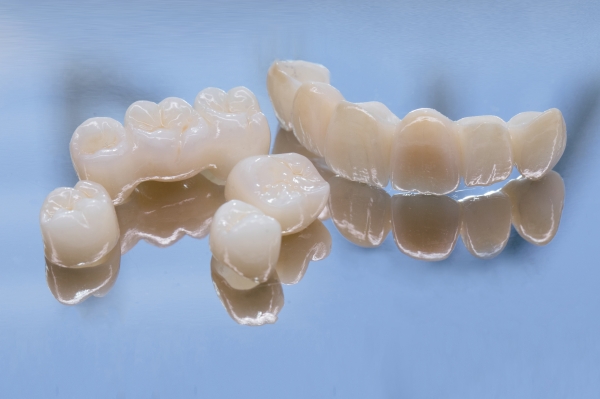 Bọc răng sứ toàn sứ là gì? Một số ưu điểm của răng toàn sứ cao cấp