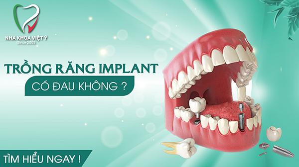 Phương pháp trồng răng Implant có đau không?